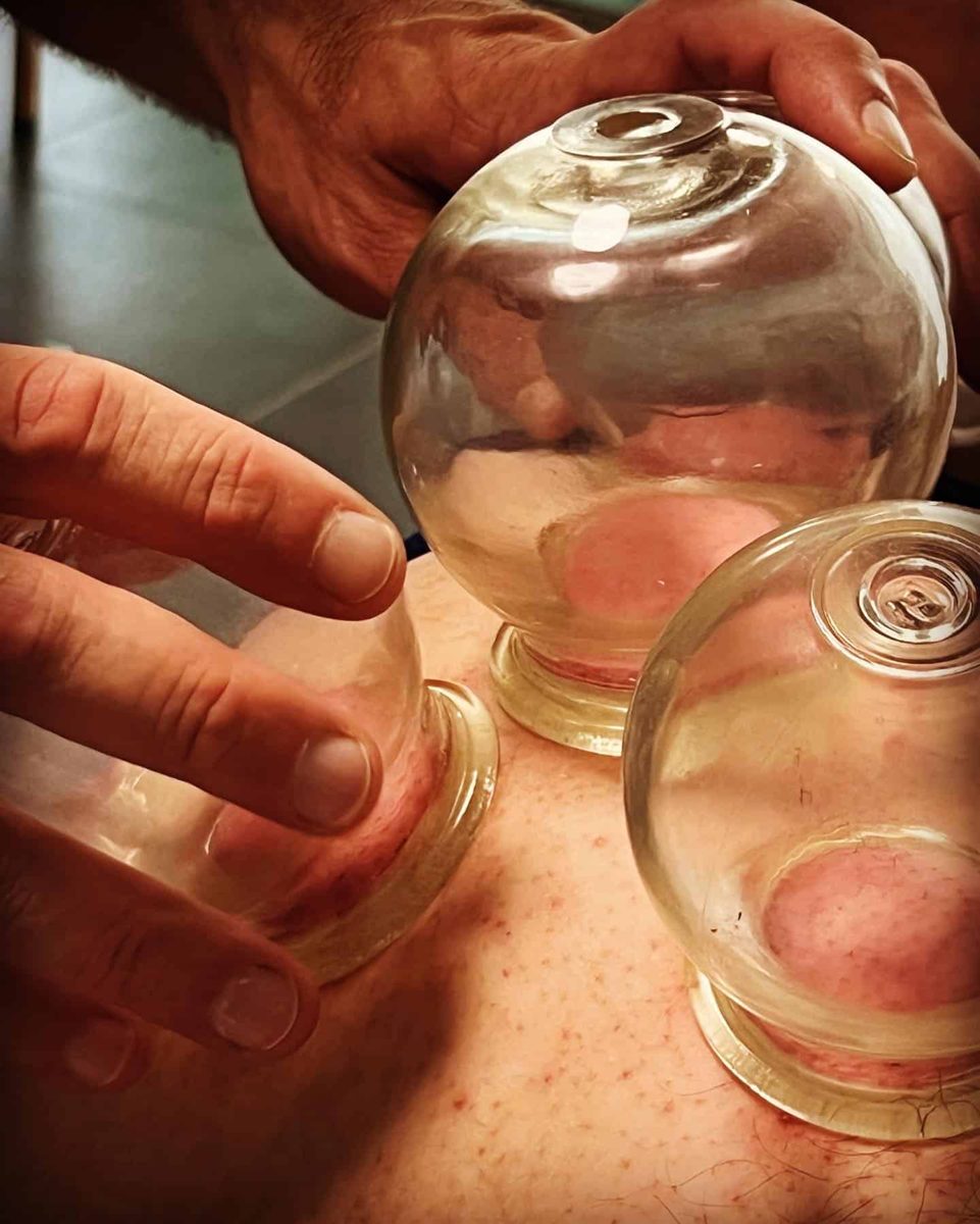 Ventouses en verre posées pendant un soin